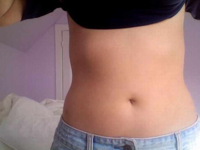 Gydymo NEOflorax kapsulėmis rezultatas