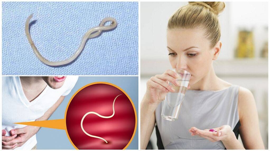 Kaip teisingai vartoti NEOflorax