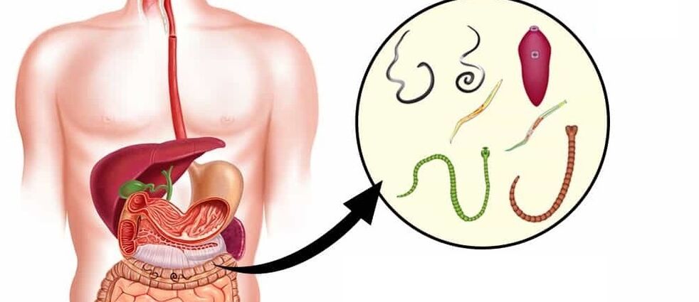 Parazitai žmogaus organizme