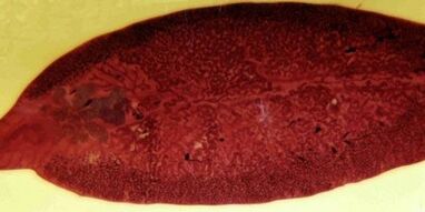 Trematodo parazitas kaip pašalinti iš organizmo