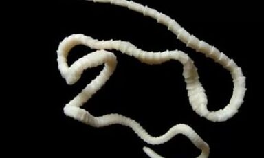 kaip pašalinti cestodo parazitą iš organizmo