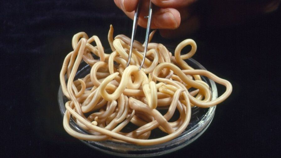 parazitai iš žmogaus kūno